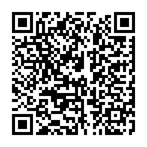 QR code to scan for Vital Guardian user feedback survey - help shape kidney wellness features